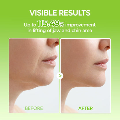 Dr.Melaxin CACTOX V-Lifting Mewing Band